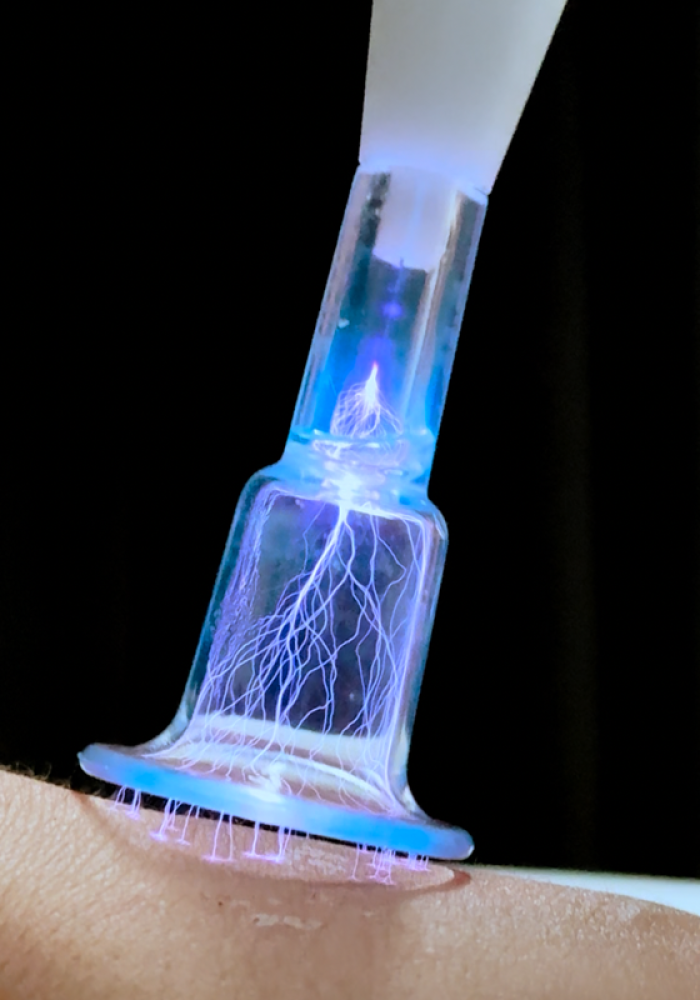 HYBRID COLD AND WARM PLASMA