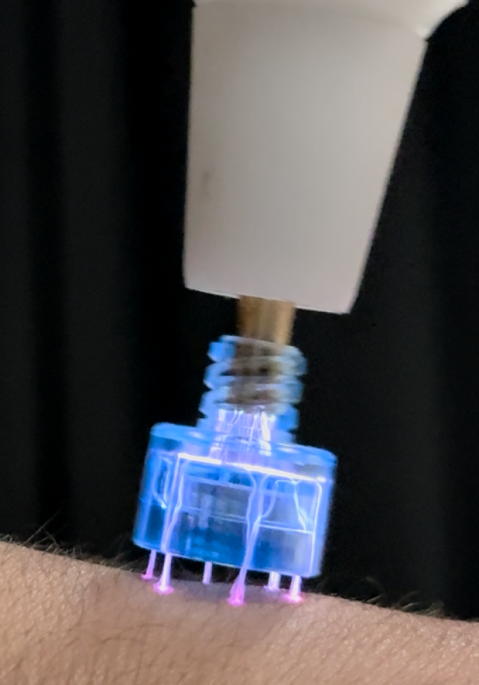 HYBRID COLD AND WARM PLASMA